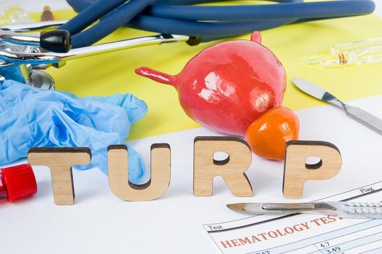 At what stage does one require a TURP surgery